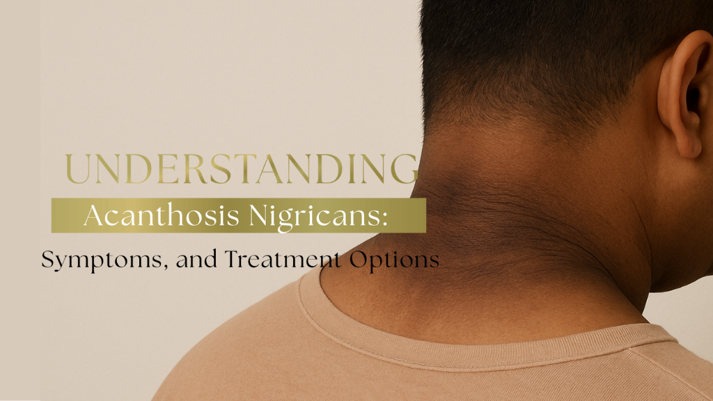 How to treat with Acanthosis Nigricans?