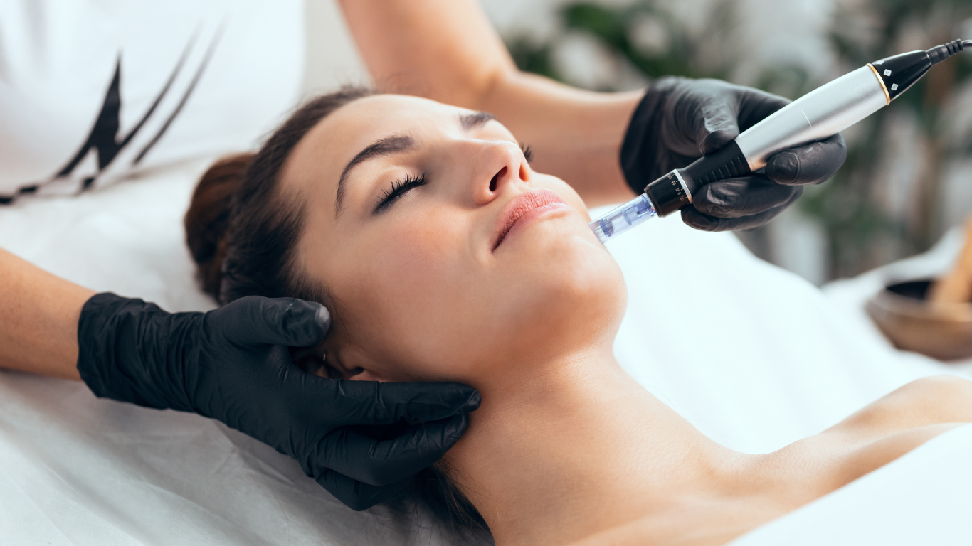 Why should I Go For Microneedling?